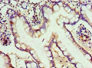 ALKBH2 antibody