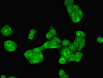ALKBH3 Antibody