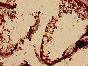 ALKBH3 Antibody
