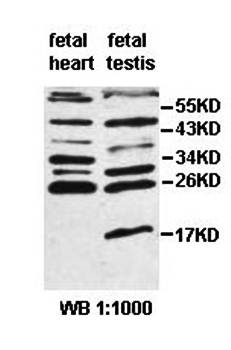 ALKBH3 Rabbit Polyclonal Antibody