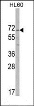 ALKBH8 antibody