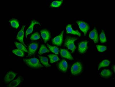 ALOX12 Antibody