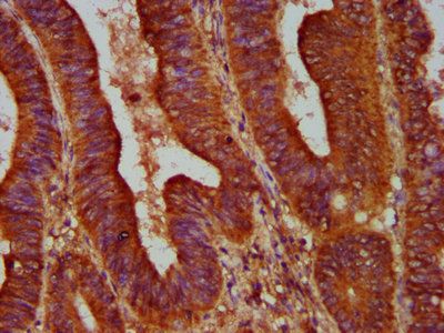 ALOX12 Antibody