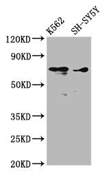 ALOX12 antibody