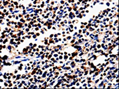 ALOX5 Antibody