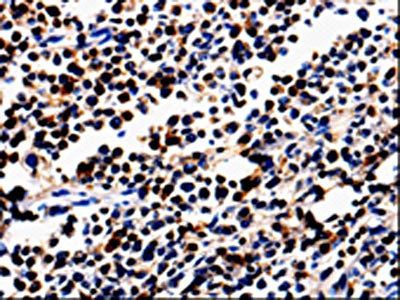 ALOX5 antibody