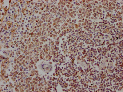 ALOX5 Recombinant Monoclonal Antibody