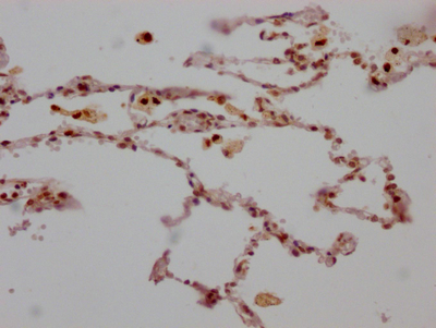 ALOX5 Recombinant Monoclonal Antibody
