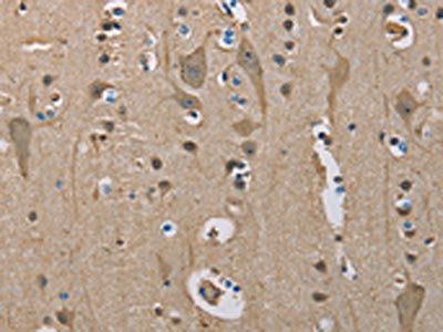SERPINA1 Antibody