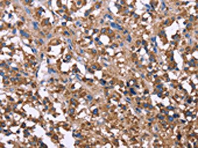 alpha 1 Antitrypsin antibody