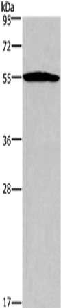 alpha 1 Antitrypsin antibody