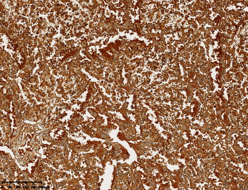 alpha 1 Fetoprotein Antibody