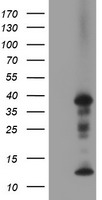 AFP Antibody