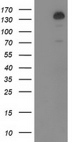 alpha 1 Fetoprotein Antibody
