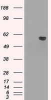 alpha 1 Fetoprotein Antibody