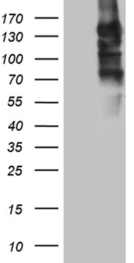 alpha 1 Fetoprotein Antibody