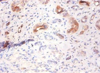 AHSG Antibody