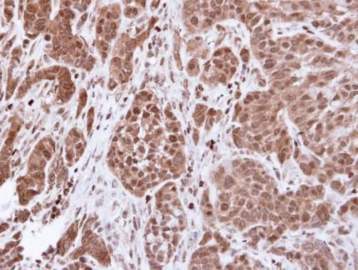 alpha Actinin 4 antibody [N2C1], Internal