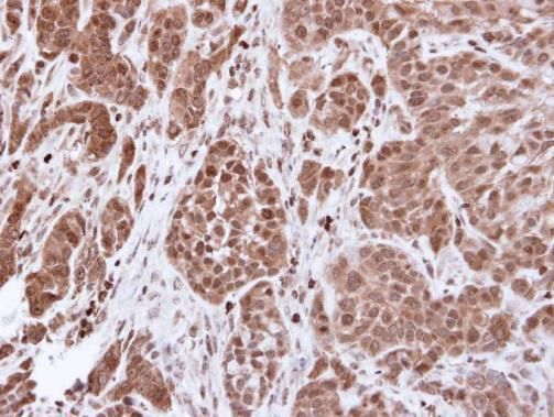 alpha Actinin 4 antibody