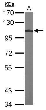 alpha Actinin 4 antibody [N2C1], Internal
