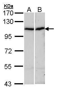 alpha Actinin 4 antibody [N2C1], Internal