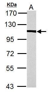 alpha Actinin 4 antibody [N2C1], Internal