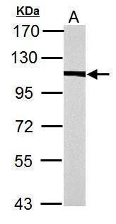 alpha Actinin 4 antibody