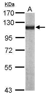 alpha Actinin 4 antibody [N2C1], Internal