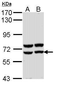 alpha amylase 2A (pancreatic) antibody