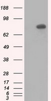 Alpha B Crystallin Antibody