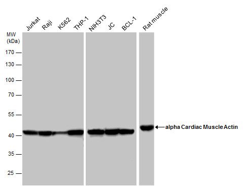 alpha Cardiac Muscle Actin Rabbit Polyclonal Antibody