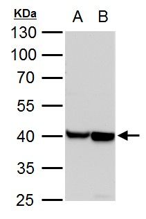 alpha Cardiac Muscle Actin Rabbit Polyclonal Antibody