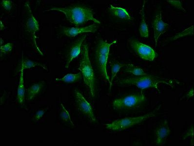 CRYAB Antibody