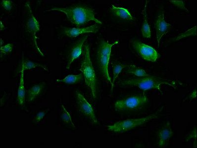 Alpha-crystallin B chain antibody