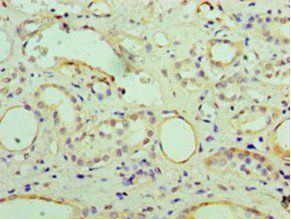 Alpha-crystallin B chain antibody