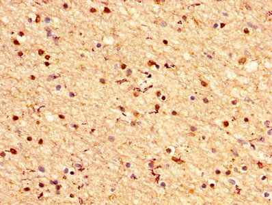 CRYAB Antibody
