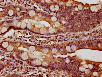 CTNNA1 Antibody
