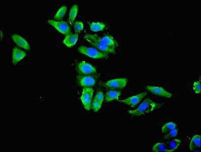 Alpha-enolase antibody