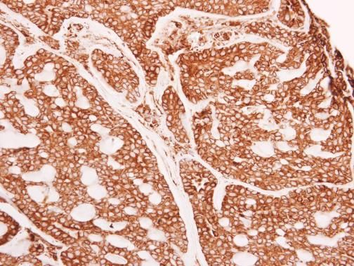 glucosidase II alpha subunit Antibody