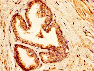 Alpha-L-iduronidase antibody