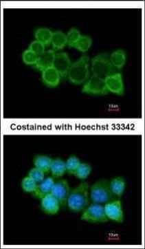 alpha SNAP antibody [N2C3]