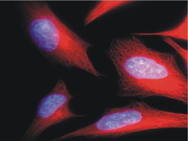 alpha tubulin antibody