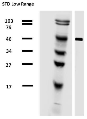 alpha tubulin antibody