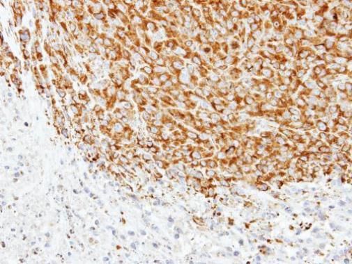 alpha Tubulin 1A antibody