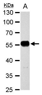 alpha Tubulin antibody