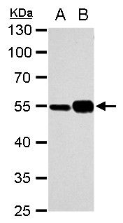 alpha Tubulin antibody