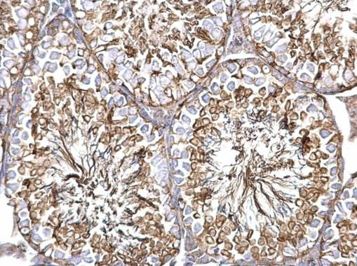 alpha Tubulin 1A antibody
