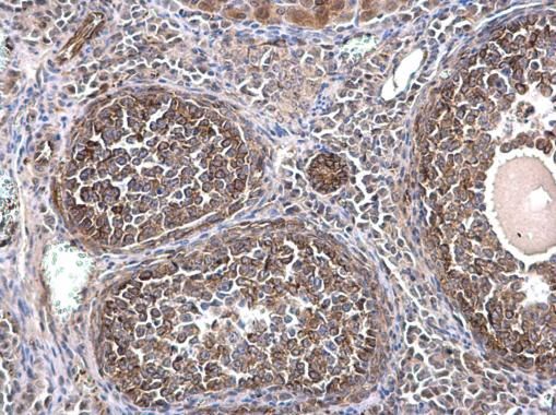 alpha Tubulin 1A antibody