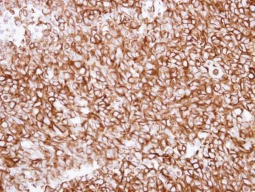 alpha Tubulin 1A antibody