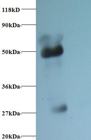 α1-acidglycoprotein Antibody (Biotin)